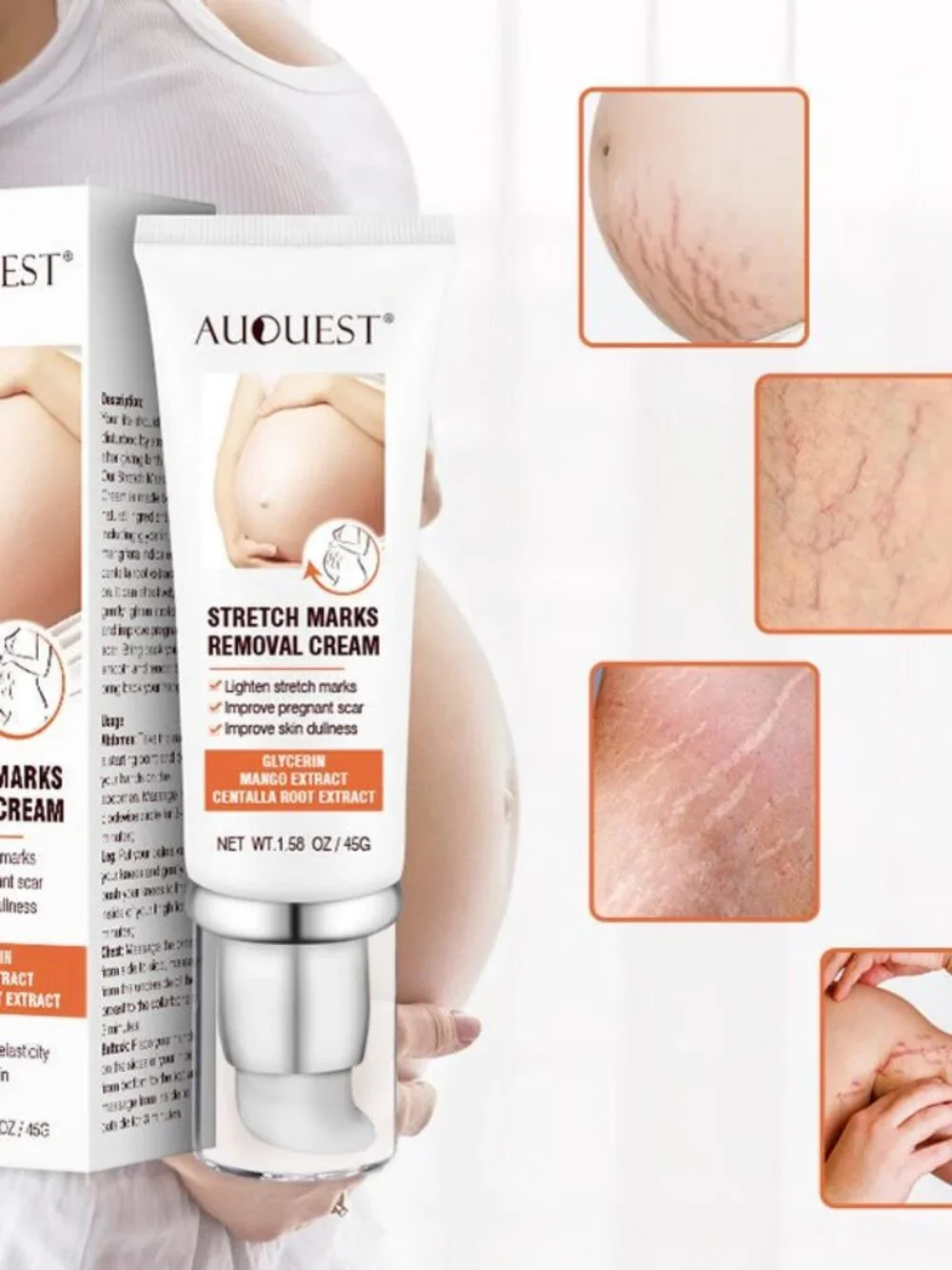 Remove Pregnancy Scars Acne Cream Stretch Mark Treatment Maternity Repair Anti-A